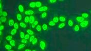 CHLOROQUINE 3
