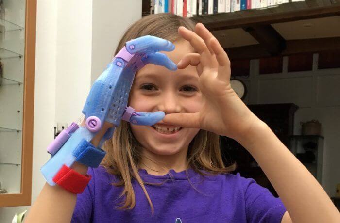 Une petite fille fait un coeur avec sa main et une prothèse fabriquée par le réseau e-Nable.
